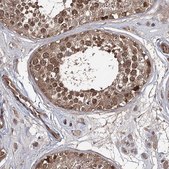 Anti-WDR48 antibody produced in rabbit Prestige Antibodies® Powered by Atlas Antibodies, affinity isolated antibody, buffered aqueous glycerol solution