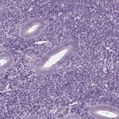 Anti-CABP5 antibody produced in rabbit Prestige Antibodies® Powered by Atlas Antibodies, affinity isolated antibody, buffered aqueous glycerol solution