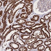 Anti-GSTM1 antibody produced in rabbit Prestige Antibodies® Powered by Atlas Antibodies, affinity isolated antibody, buffered aqueous glycerol solution