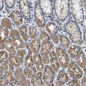 Anti-AGK antibody produced in rabbit Prestige Antibodies® Powered by Atlas Antibodies, affinity isolated antibody, buffered aqueous glycerol solution