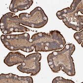 Anti-CHMP4C antibody produced in rabbit affinity isolated antibody, buffered aqueous glycerol solution