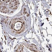 Anti-MAP4 antibody produced in rabbit Prestige Antibodies® Powered by Atlas Antibodies, affinity isolated antibody, buffered aqueous glycerol solution