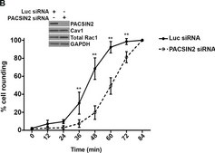 Anticorps anti-Rac1, clone 23A8 clone 23A8, Upstate®, from mouse