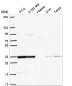 Anti-DERA antibody produced in rabbit Prestige Antibodies® Powered by Atlas Antibodies, affinity isolated antibody