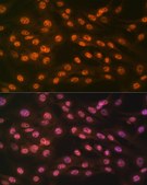 Anti-KDM4B/JMJD2B Antibody, clone 8I0I1, Rabbit Monoclonal