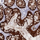 Anti-CSNK1G2 antibody produced in rabbit Prestige Antibodies® Powered by Atlas Antibodies, affinity isolated antibody, buffered aqueous glycerol solution