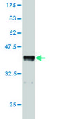 Monoclonal Anti-CHRNA5 antibody produced in mouse clone 7D3, purified immunoglobulin, buffered aqueous solution