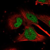 Anti-GSK3B antibody produced in rabbit affinity isolated antibody, buffered aqueous glycerol solution