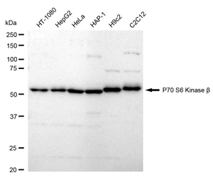 KD-Validated Anti Ribosomal Protein S6 Kinase B2 Antibody, clone 24GB1235, Rabbit Monoclonal clone 24GB1235, recombinant rabbit monoclonal, expressed in HEK293 cells