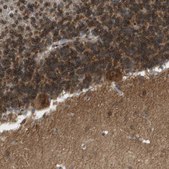 Anti-CACNB4 antibody produced in rabbit Prestige Antibodies® Powered by Atlas Antibodies, affinity isolated antibody, buffered aqueous glycerol solution
