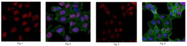 Anti-Chromobox protein homolog 5 Antibody from rabbit, purified by affinity chromatography