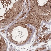 Anti-PSMA1 antibody produced in rabbit Prestige Antibodies® Powered by Atlas Antibodies, affinity isolated antibody, buffered aqueous glycerol solution