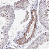 Anti-FZD2 antibody produced in rabbit Prestige Antibodies® Powered by Atlas Antibodies, affinity isolated antibody, buffered aqueous glycerol solution