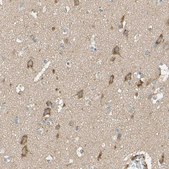Anti-DKK3 antibody produced in rabbit Prestige Antibodies® Powered by Atlas Antibodies, affinity isolated antibody, buffered aqueous glycerol solution