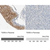 Anti-TGFBI antibody produced in rabbit Prestige Antibodies® Powered by Atlas Antibodies, affinity isolated antibody, buffered aqueous glycerol solution