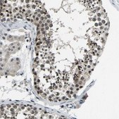 Anti-ING2 antibody produced in rabbit Prestige Antibodies® Powered by Atlas Antibodies, affinity isolated antibody, buffered aqueous glycerol solution