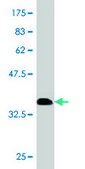 Monoclonal Anti-RNF26 antibody produced in mouse clone 5B9, purified immunoglobulin, buffered aqueous solution