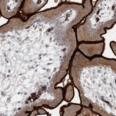 Anti-SLC39A8 antibody produced in rabbit Prestige Antibodies® Powered by Atlas Antibodies, affinity isolated antibody, buffered aqueous glycerol solution