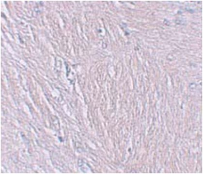 Anti-Synaptopodin Antibody from rabbit, purified by affinity chromatography