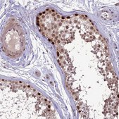 Anti-DIS3 antibody produced in rabbit affinity isolated antibody, buffered aqueous glycerol solution