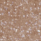 Anti-SLC17A7 antibody produced in rabbit Prestige Antibodies® Powered by Atlas Antibodies, affinity isolated antibody, buffered aqueous glycerol solution