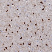 Anti-PPP1R14A antibody produced in rabbit Prestige Antibodies® Powered by Atlas Antibodies, affinity isolated antibody, buffered aqueous glycerol solution