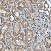 Anti-SNX14 antibody produced in rabbit Prestige Antibodies® Powered by Atlas Antibodies, affinity isolated antibody, buffered aqueous glycerol solution