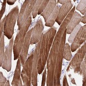 Anti-SYNM antibody produced in rabbit Prestige Antibodies® Powered by Atlas Antibodies, affinity isolated antibody, buffered aqueous glycerol solution