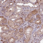 Anti-GABARAPL1 antibody produced in rabbit Prestige Antibodies® Powered by Atlas Antibodies, affinity isolated antibody, buffered aqueous glycerol solution