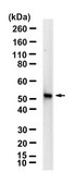 Anti-CYP11B1 Antibody, clone 1J14 ZooMAb® Rabbit Monoclonal recombinant, expressed in HEK 293 cells