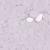 Anti-PRKCSH antibody produced in rabbit Prestige Antibodies® Powered by Atlas Antibodies, affinity isolated antibody, buffered aqueous glycerol solution