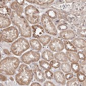 Anti-USP21 antibody produced in rabbit Prestige Antibodies® Powered by Atlas Antibodies, affinity isolated antibody, buffered aqueous glycerol solution
