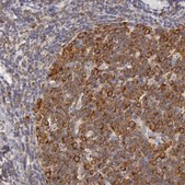 Anti-DDX3X antibody produced in rabbit Ab1, Prestige Antibodies® Powered by Atlas Antibodies, affinity isolated antibody, buffered aqueous glycerol solution