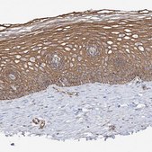 Anti-DCDC2 antibody produced in rabbit Prestige Antibodies® Powered by Atlas Antibodies, affinity isolated antibody, buffered aqueous glycerol solution