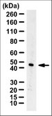 Anti-AMACR Antibody, clone 2A10F3 ascites fluid, clone 2A10F3, from mouse