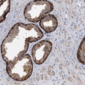 Anti-PYGB antibody produced in rabbit Prestige Antibodies® Powered by Atlas Antibodies, affinity isolated antibody, buffered aqueous glycerol solution