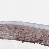 Anti-TGFBI antibody produced in rabbit Prestige Antibodies® Powered by Atlas Antibodies, affinity isolated antibody, buffered aqueous glycerol solution