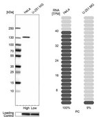 Anti-PC antibody produced in rabbit Prestige Antibodies® Powered by Atlas Antibodies, affinity isolated antibody, buffered aqueous glycerol solution