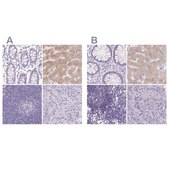 Anti-ASGR2 antibody produced in rabbit Prestige Antibodies® Powered by Atlas Antibodies, affinity isolated antibody, buffered aqueous glycerol solution