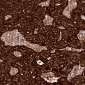 Anti-REXO2 antibody produced in rabbit Prestige Antibodies® Powered by Atlas Antibodies, affinity isolated antibody, buffered aqueous glycerol solution
