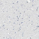 Anti-FMO5 antibody produced in rabbit Prestige Antibodies® Powered by Atlas Antibodies, affinity isolated antibody, buffered aqueous glycerol solution