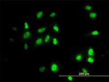 Monoclonal Anti-RAD18 antibody produced in mouse clone 3H7, purified immunoglobulin, buffered aqueous solution