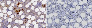 Anti-TGF-β1 Antibody, clone 4E3 ZooMAb® Rabbit Monoclonal recombinant, expressed in HEK 293 cells