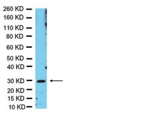 Anti-Olig3 Antibody Chemicon®, from rabbit