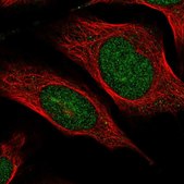 Anti-VWA5A antibody produced in rabbit Prestige Antibodies® Powered by Atlas Antibodies, affinity isolated antibody, buffered aqueous glycerol solution