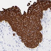 Anti-KRT19 antibody produced in rabbit Prestige Antibodies® Powered by Atlas Antibodies, affinity isolated antibody, buffered aqueous glycerol solution