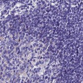 Anti-SNAP91 antibody produced in rabbit Prestige Antibodies® Powered by Atlas Antibodies, affinity isolated antibody, buffered aqueous glycerol solution