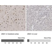 抗ZEB1 ウサギ宿主抗体 Prestige Antibodies® Powered by Atlas Antibodies, affinity isolated antibody, buffered aqueous glycerol solution