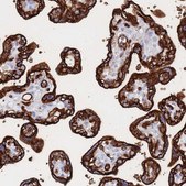 Anti-SLC2A1 antibody produced in rabbit affinity isolated antibody, buffered aqueous glycerol solution