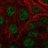 Anti-DIP2A antibody produced in rabbit Prestige Antibodies® Powered by Atlas Antibodies, affinity isolated antibody, buffered aqueous glycerol solution